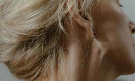 Kebiasaan Meregangkan Leher, Wanita Di AS Terserang Stroke