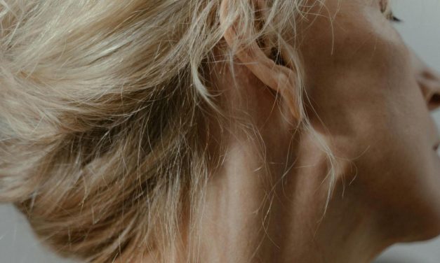 Kebiasaan Meregangkan Leher, Wanita Di AS Terserang Stroke