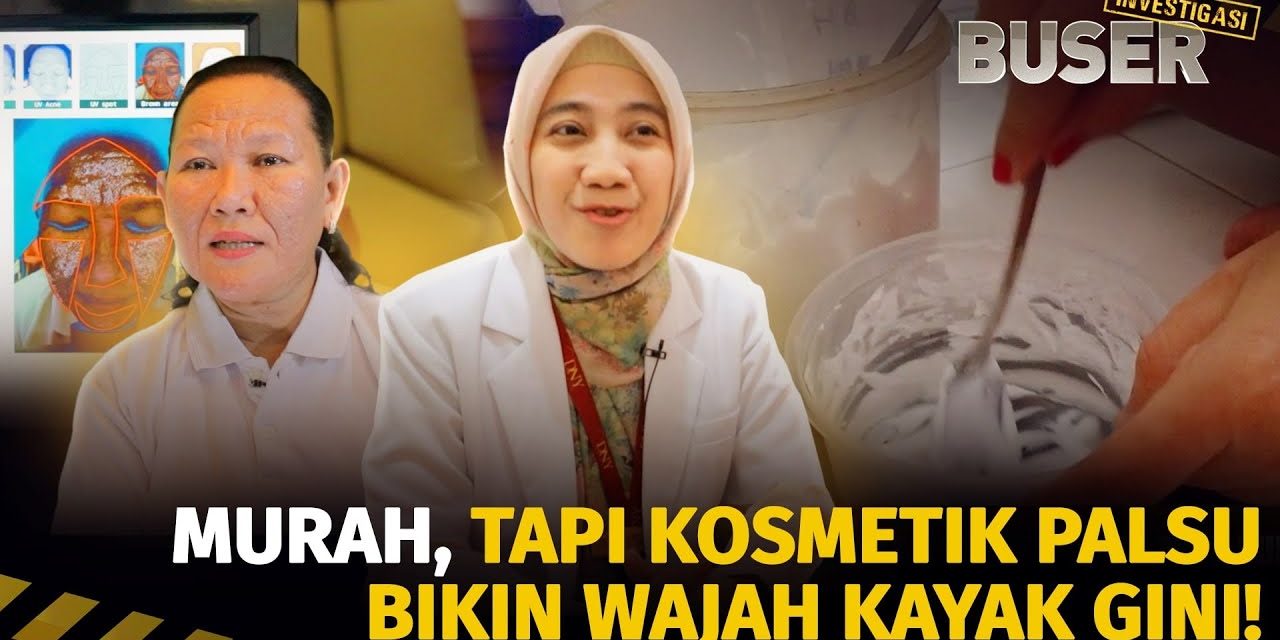 Bahaya Kosmetik Palsu: Ancaman Kesehatan Kulit Dan Tubuh
