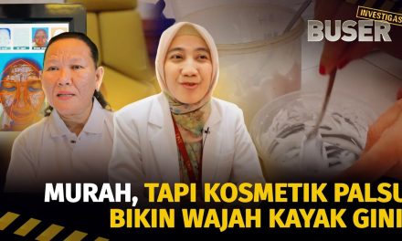 Bahaya Kosmetik Palsu: Ancaman Kesehatan Kulit Dan Tubuh