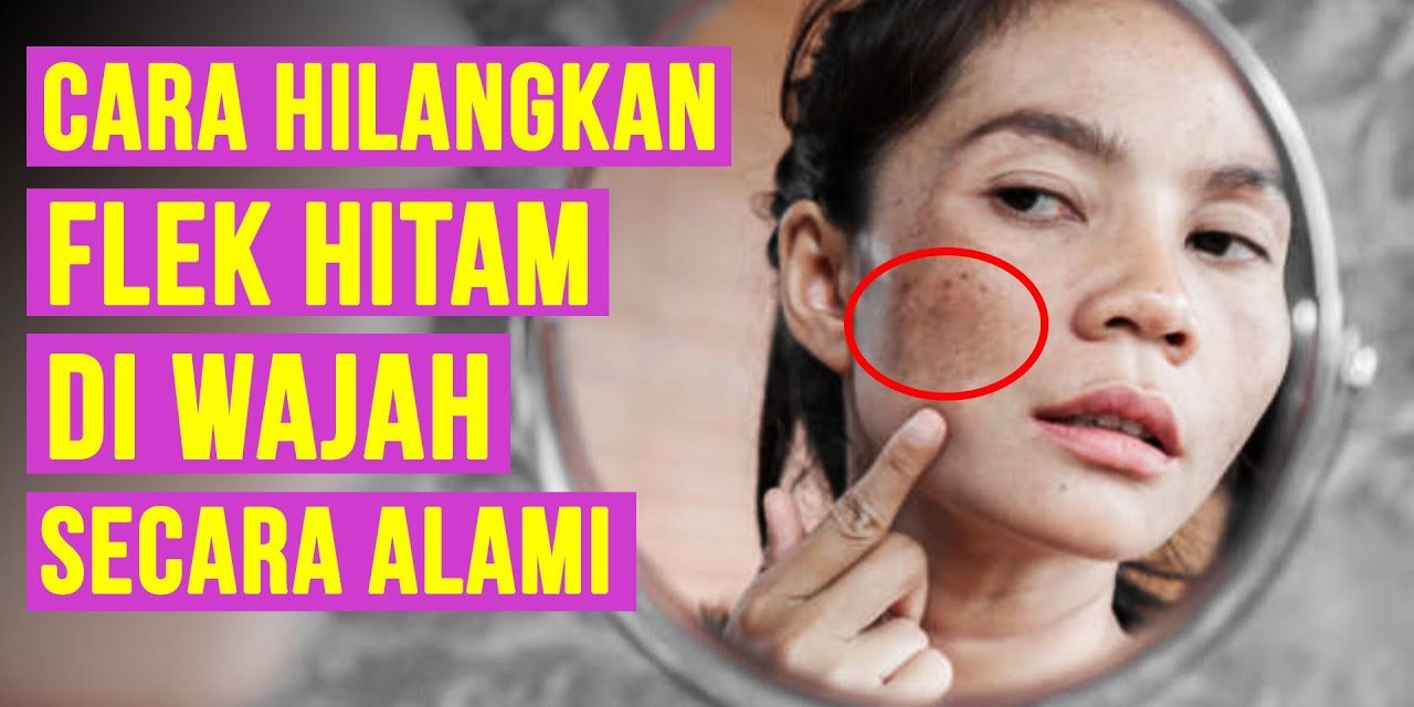 Kulit Cerah Dan Merata Bebas Flek Hitam, Ini Langkah Yang Tepat