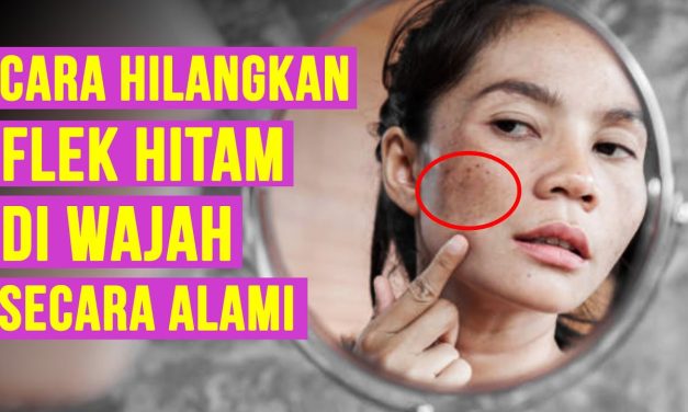 Kulit Cerah Dan Merata Bebas Flek Hitam, Ini Langkah Yang Tepat
