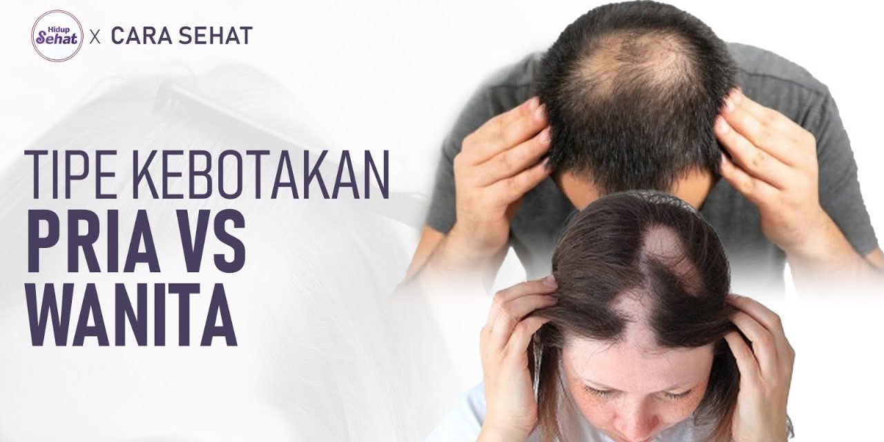 Kondisi Kebotakan Kepala Pada Rambut Seseorang