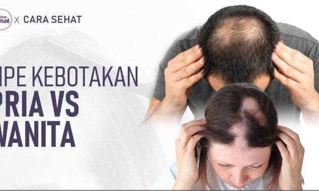 Kondisi Kebotakan Kepala Pada Rambut Seseorang