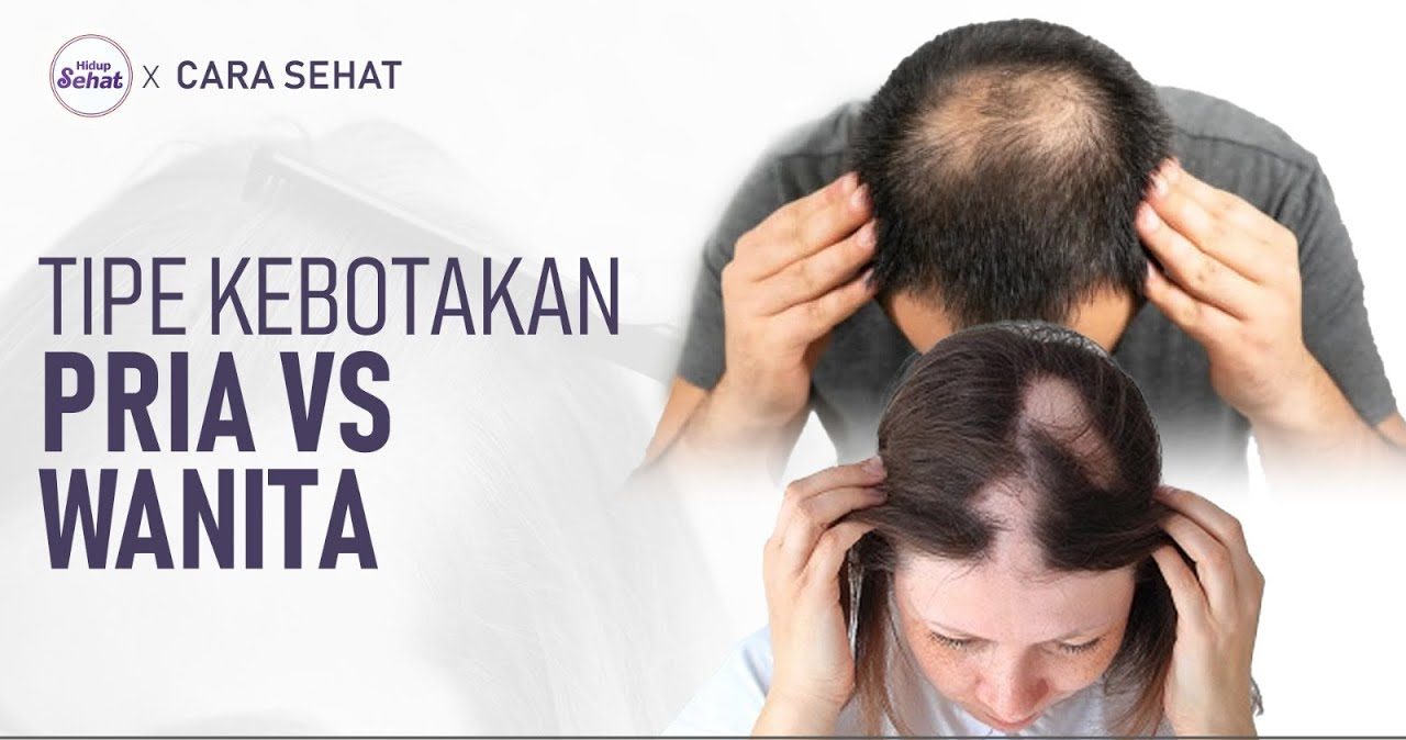 Kondisi Kebotakan Kepala