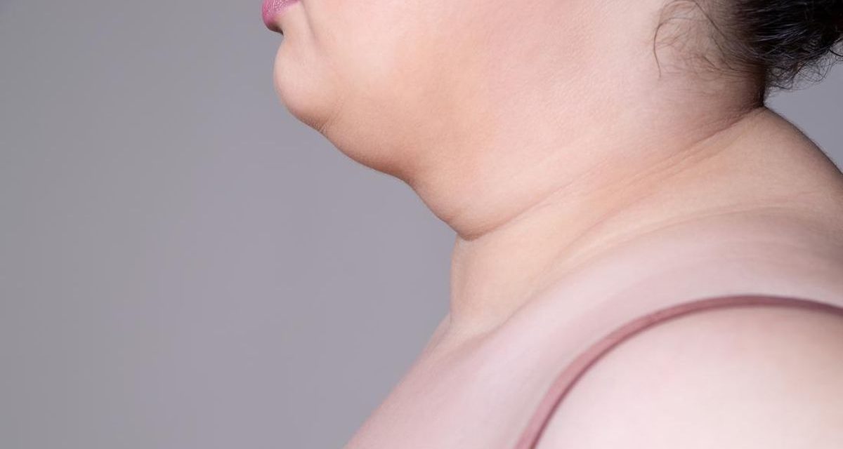 Double Chin Bikin Sebal Karena Mengganggu Penampilan