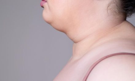 Double Chin Bikin Sebal Karena Mengganggu Penampilan