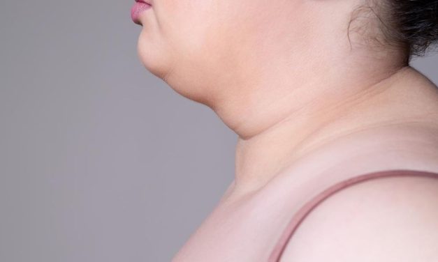 Double Chin Bikin Sebal Karena Mengganggu Penampilan